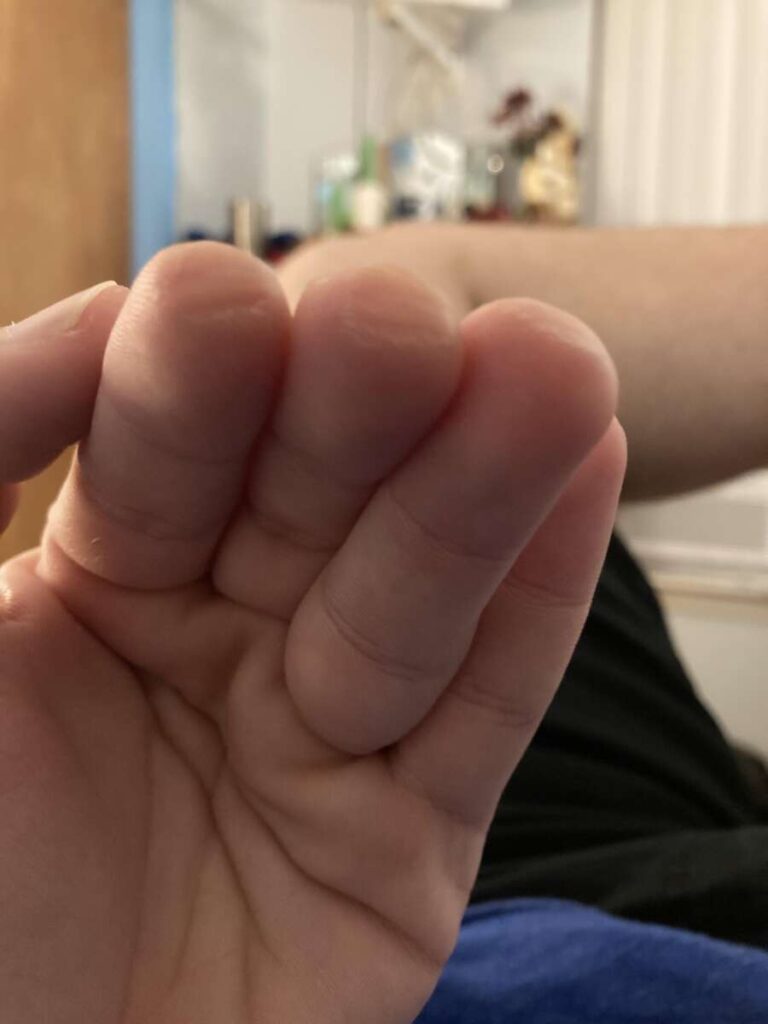How Long Does It Take To Build Calluses For Guitar