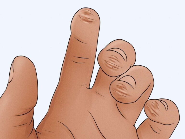 How To Build Calluses For Guitar