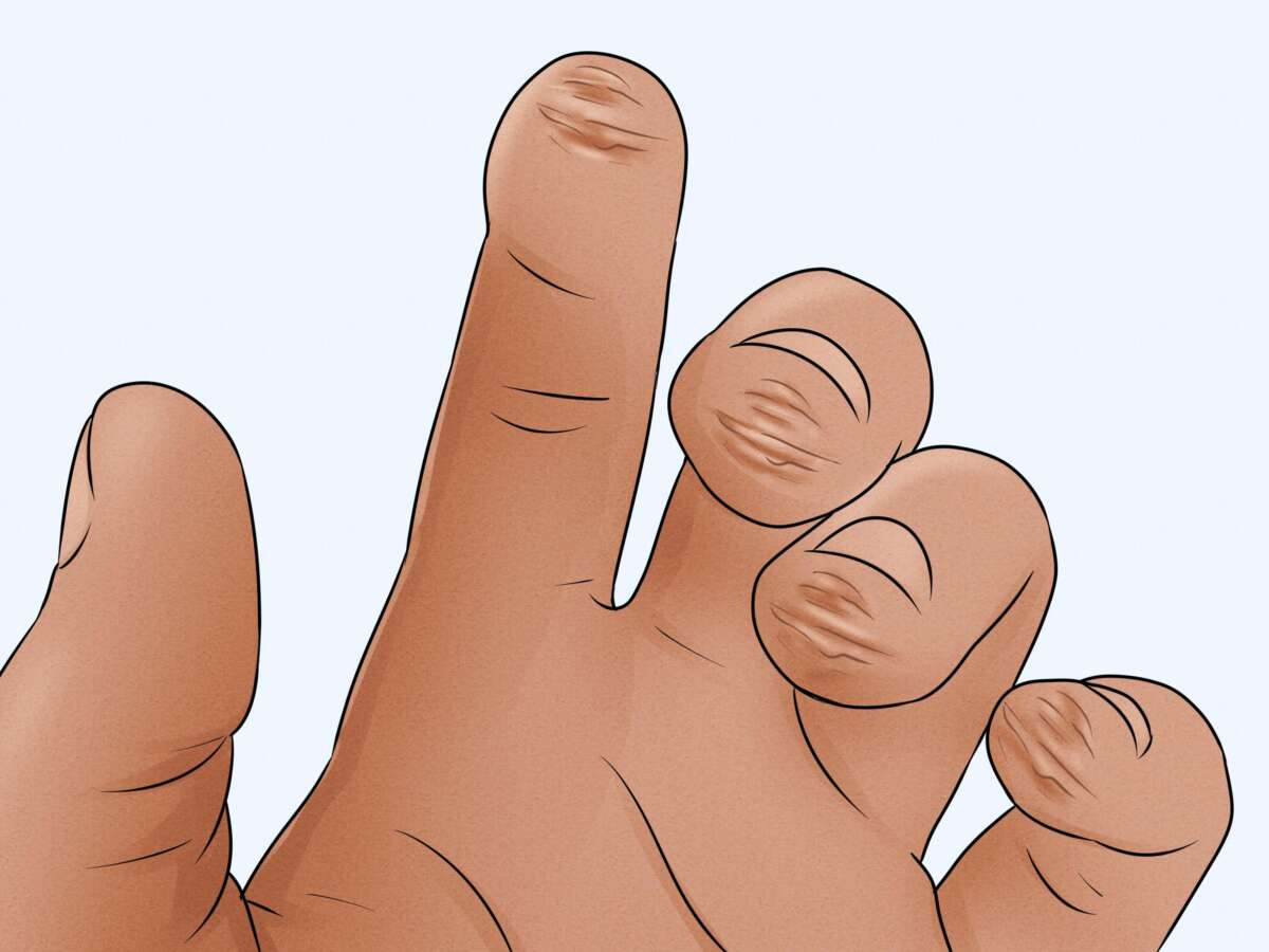 How To Build Calluses For Guitar: Fast, Safe Methods